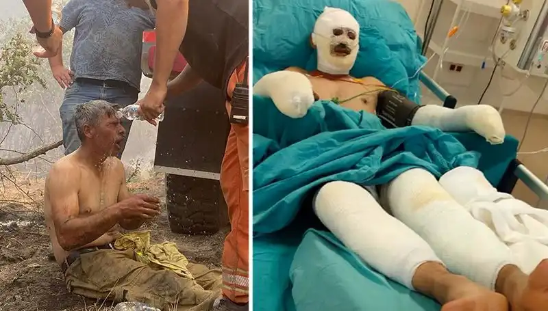 Ormanda Yanarak Can Verme Tehlikesi: Feryat Eden İşçinin Durumu Kritik