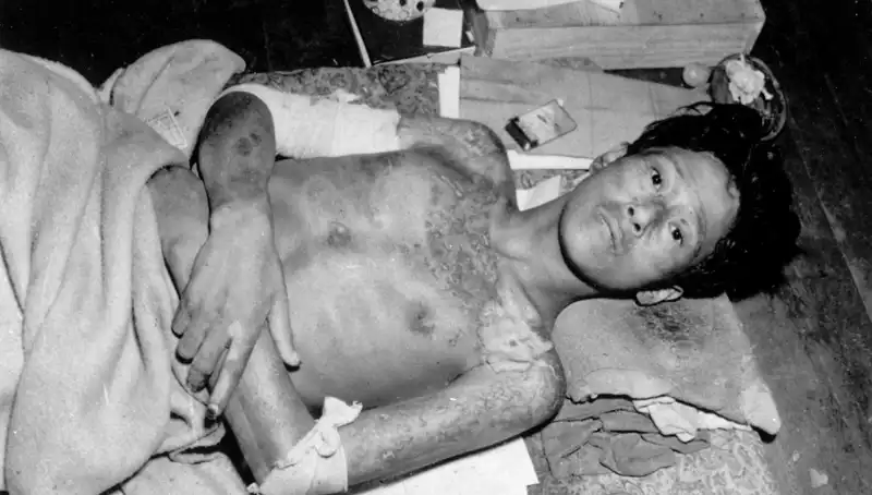 80 Yıl Sonra Nagasaki’den Korkutucu Uyarı: Nükleer Tehlike Artıyor