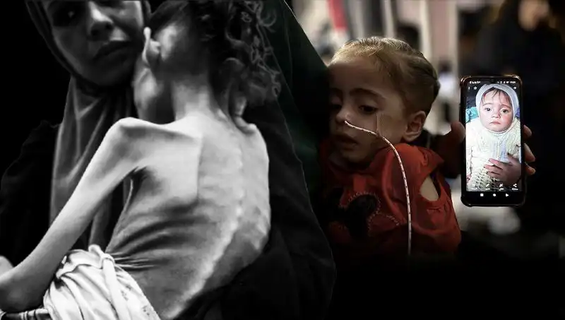 Küçük Meryem’in Açlık Mücadelesi: 25 Kilodan 10 Kiloya Düşen Yürek Yakıcı Hikaye