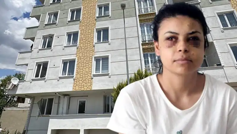 Düğün Magandası: Saçmalar Gözüne Isabet Eden Korkunç Olay