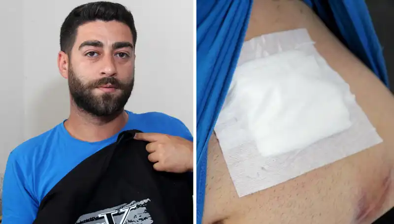 Karnında Ağrı Hissetti, Röntgen Sonucu Şok Edici Gerçeği Ortaya Çıkardı
